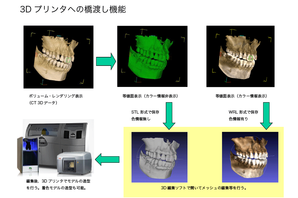 TomoShop Viewer_CTスキャンデータ(DICOMデータ)からSTLへの変換し、3Dプリンタで造形するまでのデータの流れ