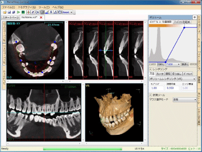 TomoShop_ボリュームレンダリング表示機能