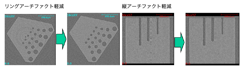 TomoShop_縦アーチファクト軽減機能